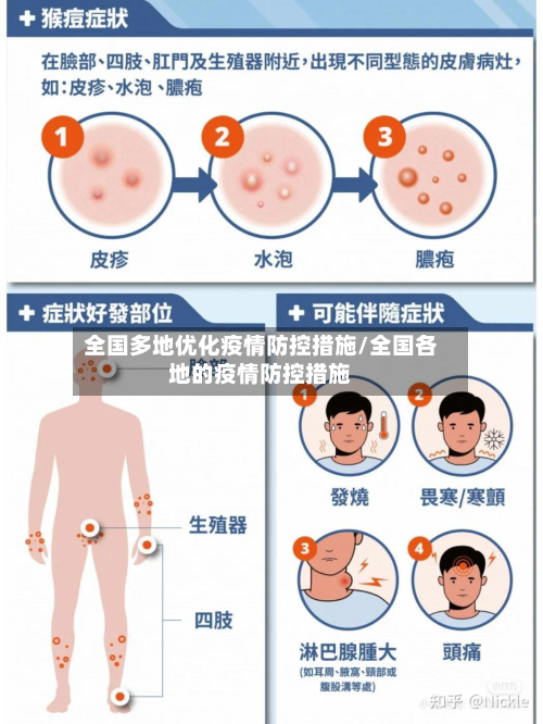 全国多地优化疫情防控措施/全国各地的疫情防控措施
